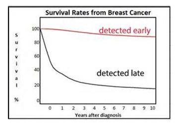 Survival Rates from Breast Cancer
